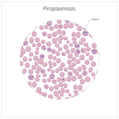 Piroplasmosis babesiosis in blood PNG illustration with transparent background