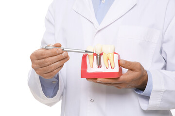 Dentist holding educational model of dental implant on white background, closeup