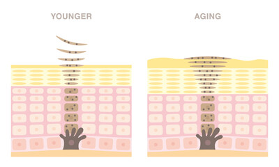 Cross section of skin cell turnover. Skin regeneration of younger and older. Older skin has spots.  Pale colored illustration in flat cartoon style.