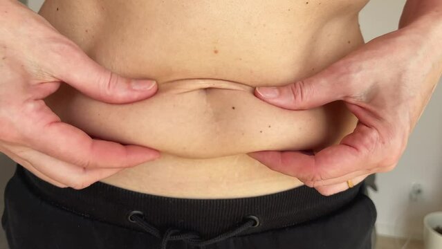 Close-up of a sagging female belly. Overweight lack of muscle, fat, the problem of flabby skin. Concept: motivation to play sports, diet, Healthy lifestyle.