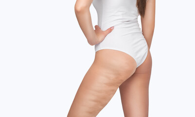 Fat woman with cellulite on her legs. Obese woman in white underwear.Overweight treatment. - obrazy, fototapety, plakaty