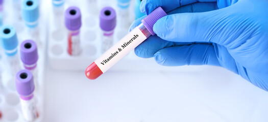 Doctor holding a test blood sample tube with Vitamins and Minerals test on the background of medical test tubes with analyzes
