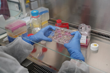 Research on chronic bacterial infections within PhD student working on brucellosis bacteria.
