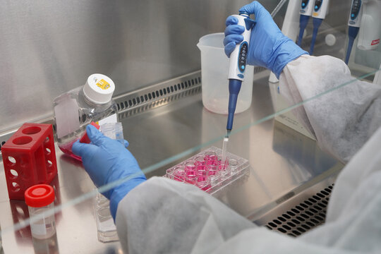 Research on chronic bacterial infections within PhD student working on brucellosis bacteria.