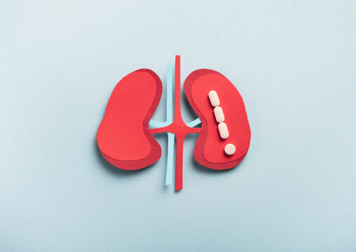 Human kidneys decorative model with pills in shape exclamation mark on light blue background. Chronic kidney disease, kidney stones, Nephrology concept. Top view