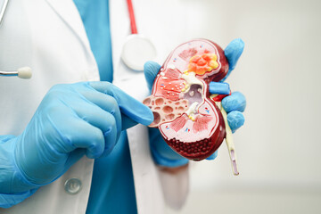 Chronic kidney disease, doctor holding model for treatment urinary system, urology, Estimated...