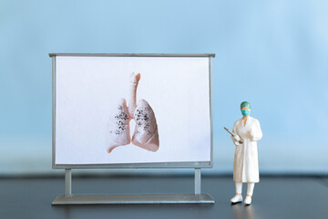 Miniature people. A doctor examines pneumonia in the picture, a respiratory disease. Pulmonary complication.