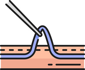 Varicose and spider veins, sclerotherapy surgery