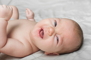 Newborn baby 2 months old with atopic dermatitis close up portrait. Baby care, colic, teething, crying.