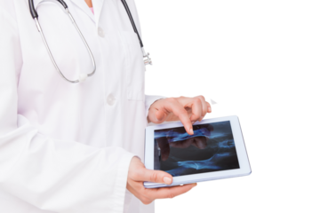 Doctor looking at xray on tablet