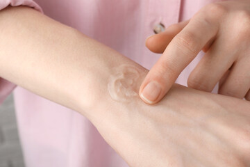 Obraz na płótnie Canvas Woman applying ointment on her hand, closeup