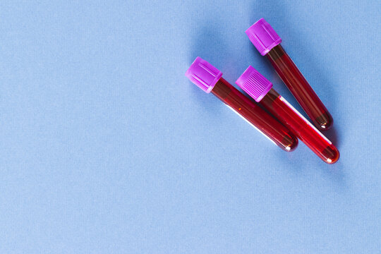 Three blood sample tubes with purple lids, on blue background with copy space