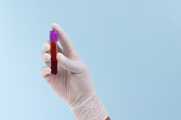Hand in white surgical glove holding blood sample tube, on blue background with copy space