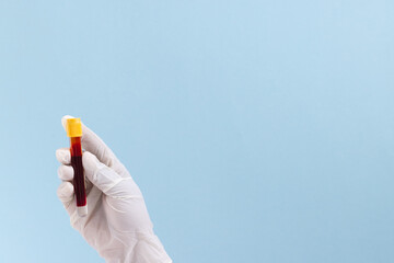 Hand in white surgical glove holding blood sample tube, on blue background with copy space