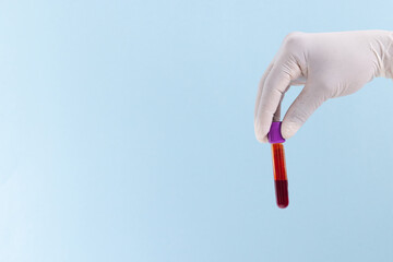 Hand in white surgical glove holding blood sample tube, on blue background with copy space