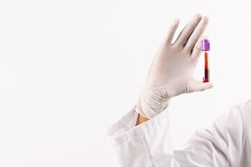 Hand in white surgical glove holding blood sample tube, on white background with copy space