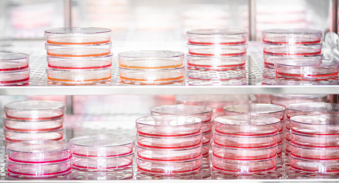 Petri dishes in an incubator used for cell culture in oncology research