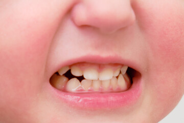 Mouth, lips and teeth of an angry toddler baby, close-up. Macro photo of grumpy child open mouth. Kid aged one year eight months