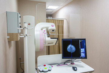 Mammography test at the hospital. Medical equipment. Mammography breast screening device in...