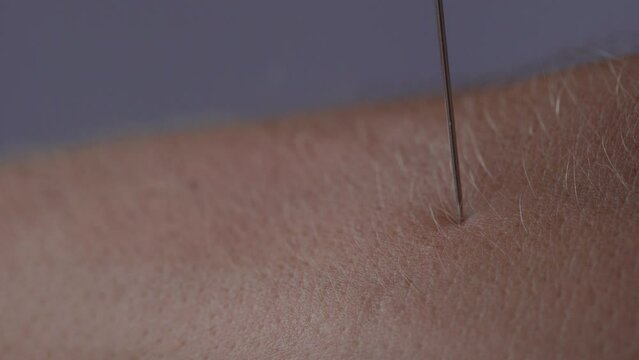 Macro close up of a needle pricks a man's hand. Dangerously contact hand skin to the sharp needle. 4K