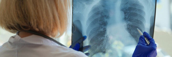 Doctor examines chest x-ray of patient in hospital