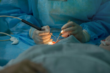 a  woman ophthalmologist performs an operation on the patient's eye.