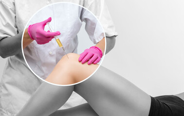 Doctor doing stem cell therapy on a patient's knee after the injury. Treating knee pain with...