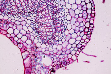 Host cells with spores (mold) are inside wood under the microscope for education.	
