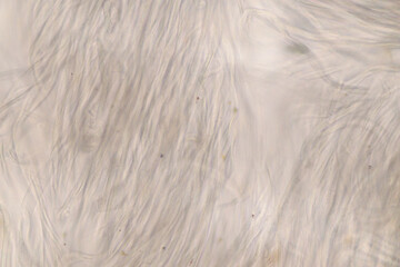 Host cells with spores (mold) are inside wood under the microscope for education.	