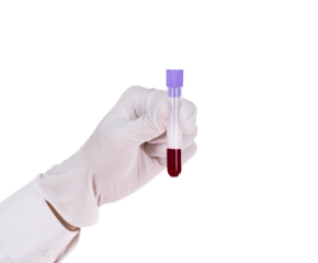 Hand holding test tube with blood on transparent background png file