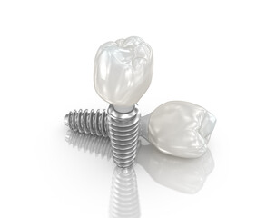 Dental implant and ceramic crown on white background. 3D illustration.