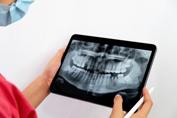 Dentist checking the x-ray on an iPad to indicate his dental treatment to the patient