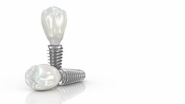 Dental implant and ceramic crown on white background. 3D animation