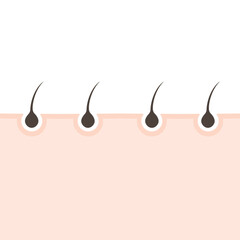 Epidermis. Hair follicle. Pores. Hair growth cycle. 