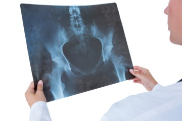 Concentrate doctor looking at X-Rays