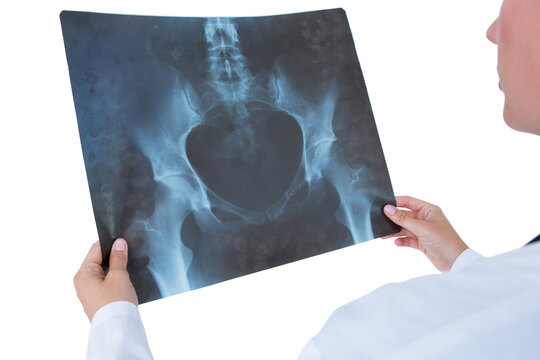 Concentrate doctor looking at X-Rays