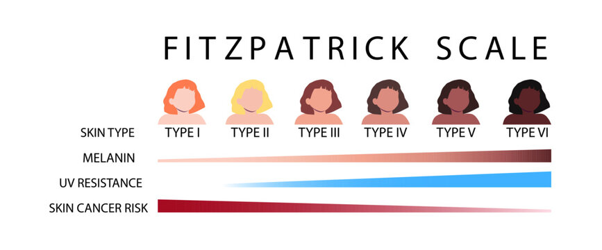 Fitzpatrick scale. Skin types infographic with female faceless characters. Human phototypes. Melanin, UV resistance and skin cancer risk diagrams. Vector illustration