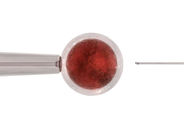 Foto op Plexiglas Intracytoplasmic sperm injection and human egg © vectorfusionart