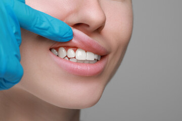 Obraz premium Doctor examining woman's gums on grey background, closeup. Space for text