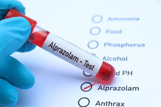 Alprazolam test to look for abnormalities from blood