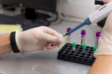 doctor hand taking a blood sample tube from a rack with machines of analysis in the lab background