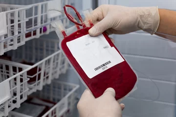 Leukocyte poor pack red cell in transfusion bag on a tray inside blood bank. Rare blood group prepares for donation or therapy of anemia patient in hospital © diter