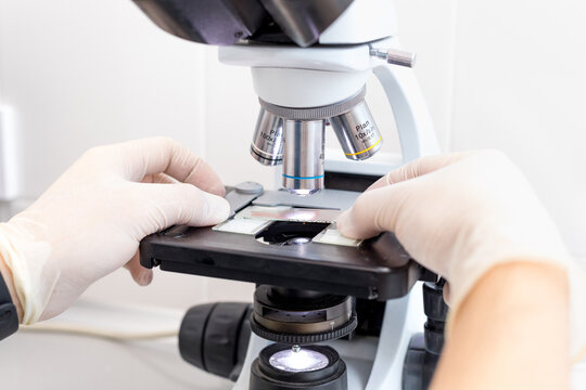the doctor's hand places a drop of blood on a microscope slide with a probe on the lab background