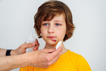Dad doctor father treats bruised wound on his son school boy kid face. Man cleans addresses the...