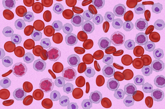 Acute lymphoblastic leukemia (ALL) cancer cell in blood flow - microscopic view 3d illustration