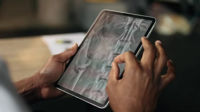 Close up hands of african doctor veterinarian thinking about diagnosis while looking at results dog pet patient online x-ray scan procedure using tablet gadget at hospital office