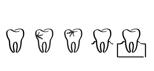 Cartoon healthy, tooth with gums, line pattern. Vector drawing silhouette icon. Damage teeth or tooth with caries. Cracked tooth, mouth and dental, damaged. Strong enamel, disease. Molar
