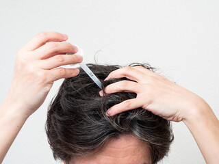 Fototapeta premium 頭皮に育毛剤を塗る男性 スカルプケア