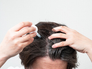 Fototapeta premium 頭皮に育毛剤を塗る男性 スカルプケア