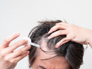 Fototapeta premium 頭皮に育毛剤を塗る男性 スカルプケア